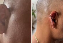Homem tem parte da orelha arrancada após ataque a facadas em Ji-Paraná