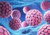 Autocoleta de HPV pode ser opção na prevenção do câncer de útero