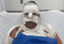 Homem tem 80% do corpo queimado após ataque em Chupinguaia; suspeito é preso em flagrante